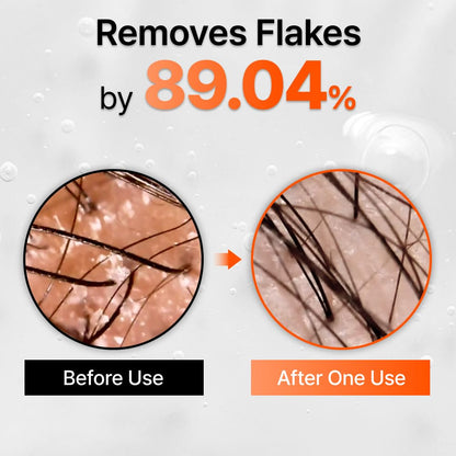 FEELBETTR Hair Grow Serum With Brush