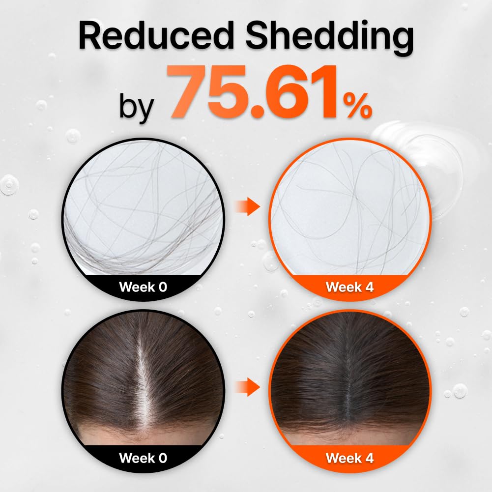 FEELBETTR Hair Grow Serum With Brush