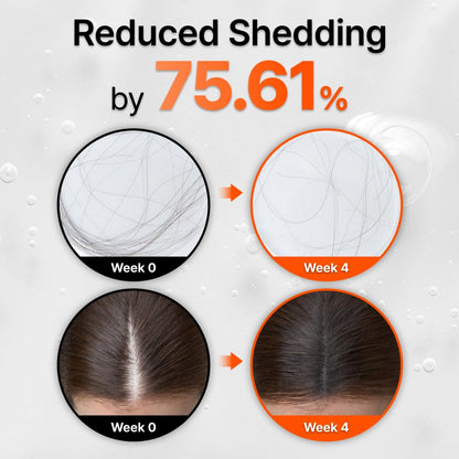 FEELBETTR Hair Grow Serum With Brush