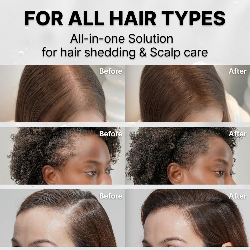 FEELBETTR Hair Grow Serum With Brush