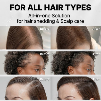 FEELBETTR Hair Grow Serum With Brush